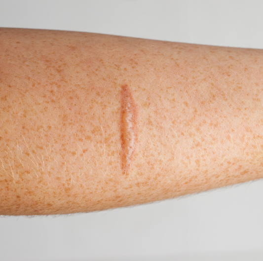 A woman with a scar