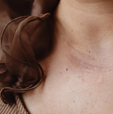What Is the Best Gel for Surgical Scars in Australia?