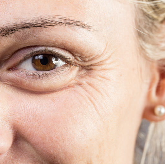 Under Eye Skin Problems