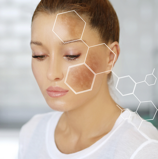 Genova Skincare can help reduce Hyperpigmentation