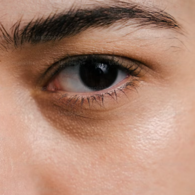 Combat Dark circles around your eyes