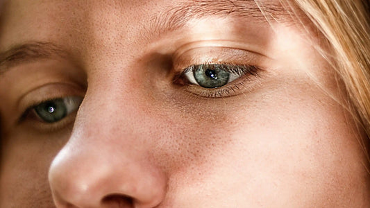 Understanding and Treating Hyperpigmentation: Your Guide to Even, Radiant Skin