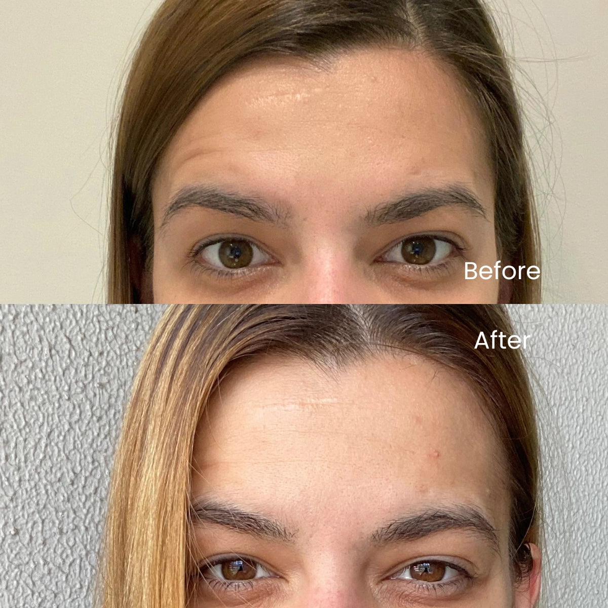 Genova Silicone Scar Gel