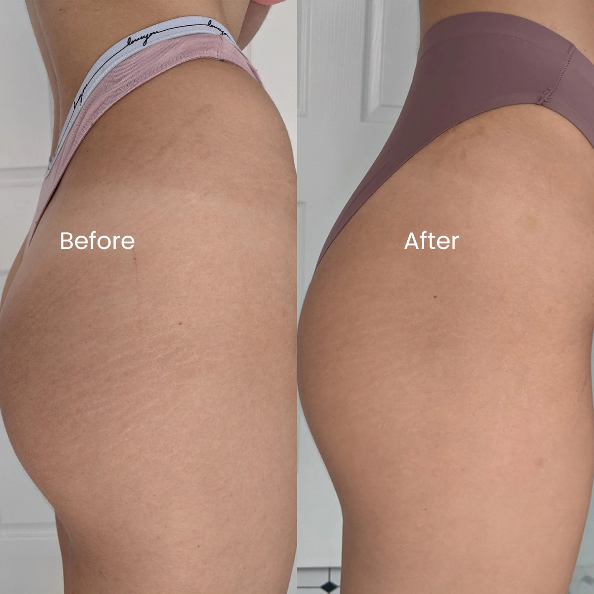 Genova Silicone Scar Gel