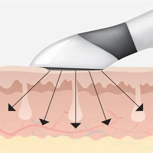 Genova Skincare ION Applicator - Iontophoresis
