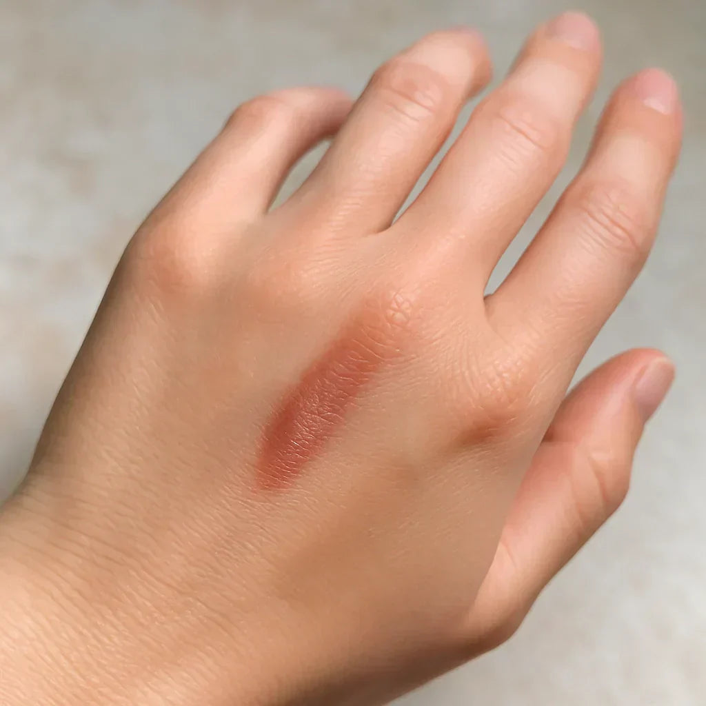What Is the Best Gel for Burn Scars in Australia?