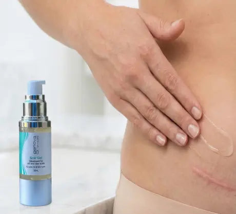 Woman applying Genova Silicone Scar Gel