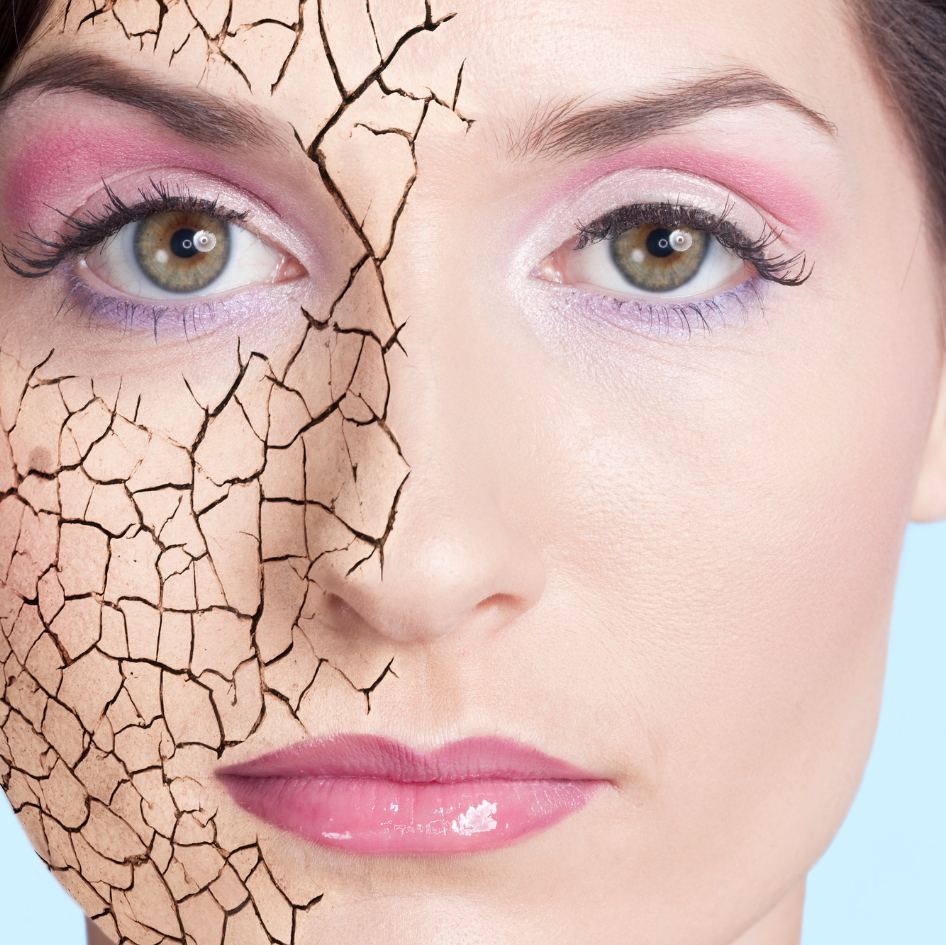 A woman with cracked skin