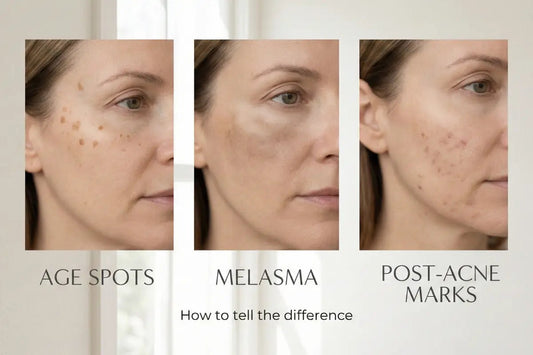 Telling the difference in dark spots