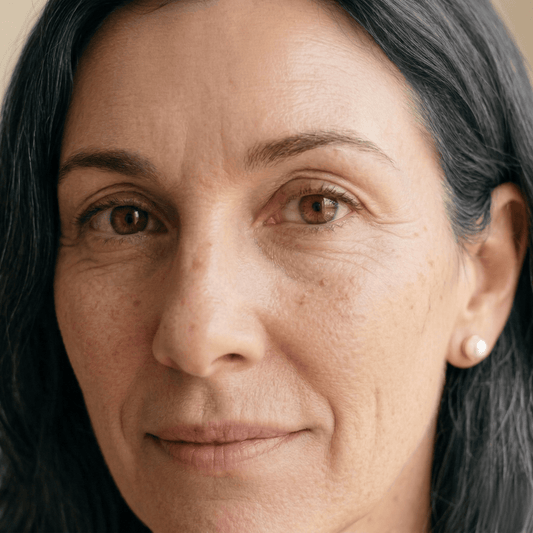 Woman in her late 50s with dark circles, under-eye puffiness and crow's feet, the menopausal eye concerns that decide between an eye serum and an eye cream after 45