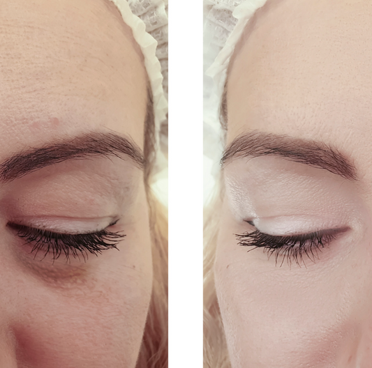 Genova Perfecting Eye Serum before and after