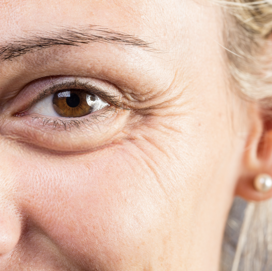 Under Eye Skin Problems