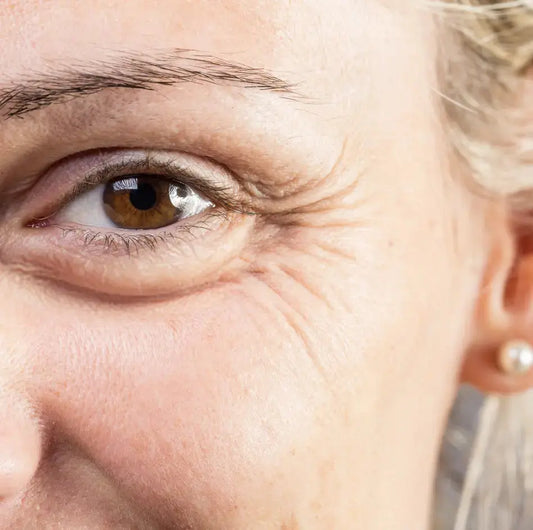 Under Eye Skin Problems
