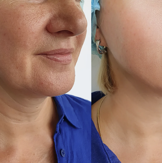A woman with neck wrinkles