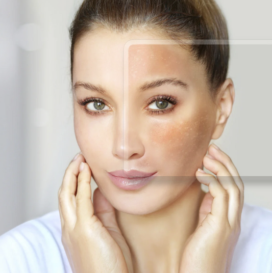 Red Active Serum to help fight Rosacea and Facial Redness