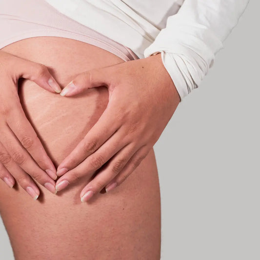 What-Makes-Genova-Stretch-Mark-Cream-the-Best-Choice-for-Smoother-Resilient-Skin Genova Skincare