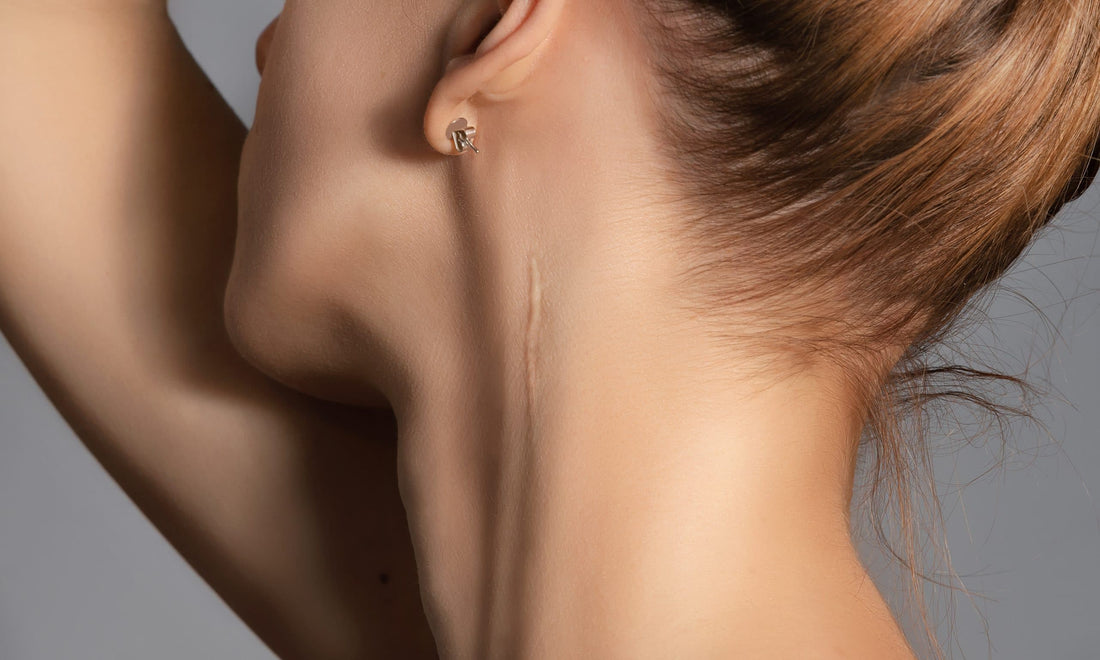 Woman Neck Scar