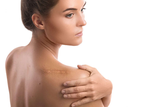 Woman with shoulder scar