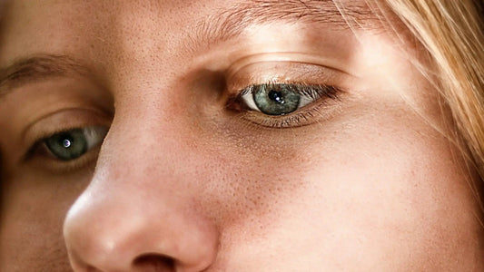 Woman with facial hyperpigmentation applying brightening skincare