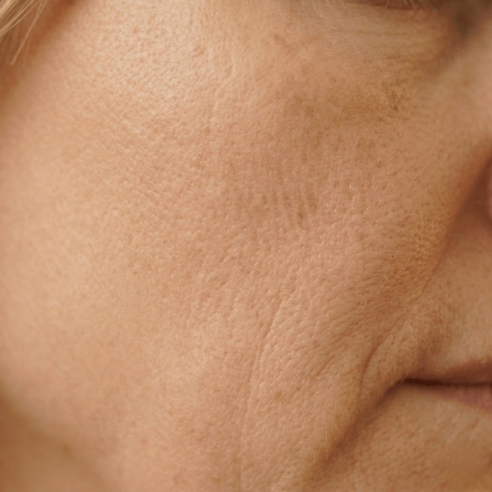 Close-up of fine lines, enlarged pores and uneven skin texture on the cheek, signs of collagen loss and reduced skin elasticity during menopause