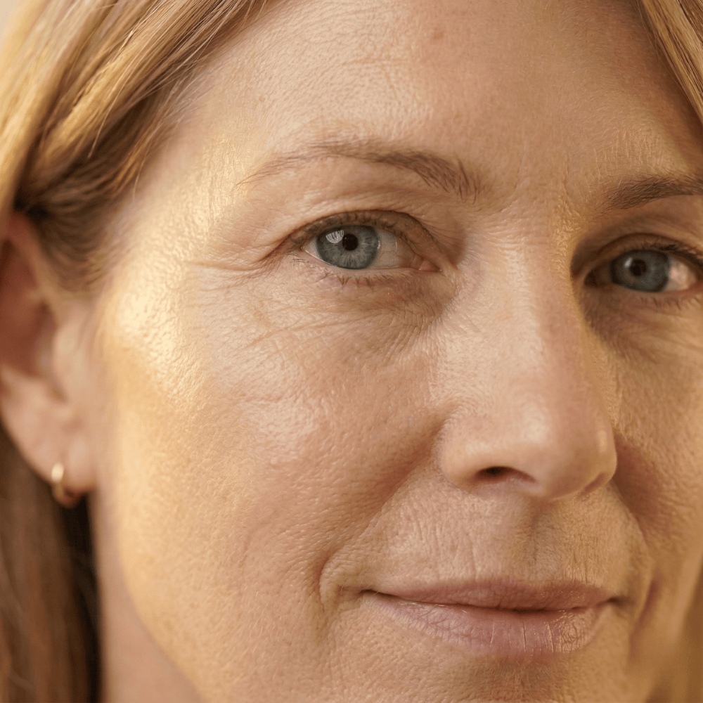Close-up of crow's feet, under-eye wrinkles and fine lines across the face of a woman in perimenopause, showing how hormonal changes affect skin around the eyes