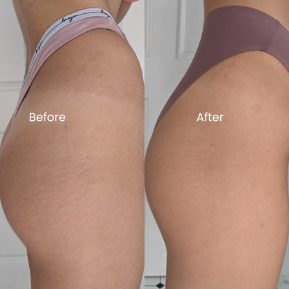 Genova Silicone Scar Gel