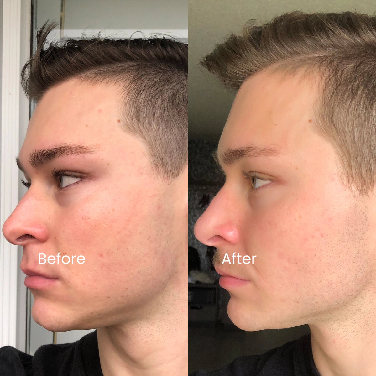 Genova Silicone Scar Gel