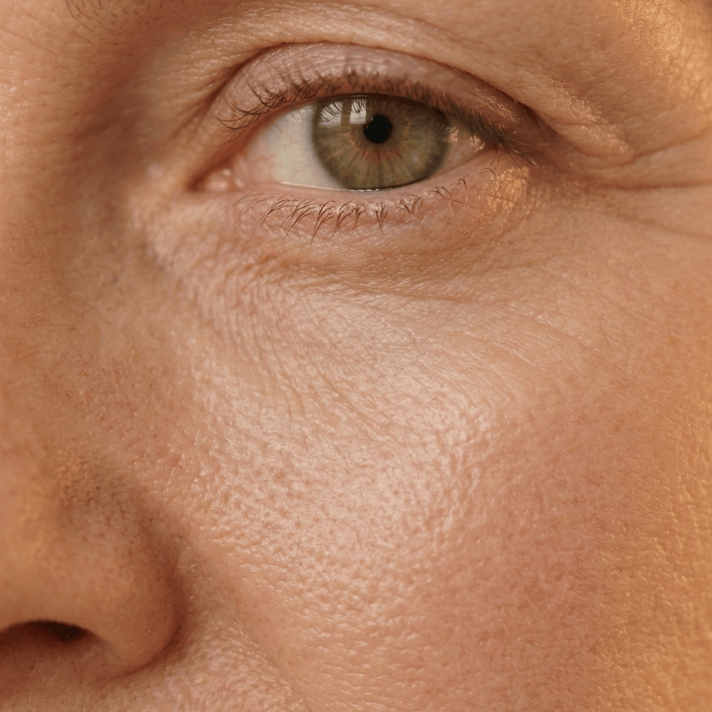 Close-up of under-eye area showing fine lines, crepey texture and puffiness on mature skin, common menopausal eye concerns that peptide eye serums may help improve