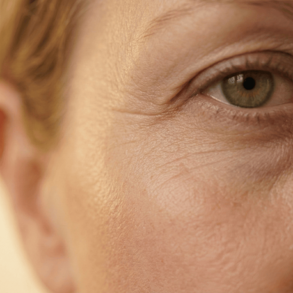 Close-up of crow's feet and under-eye wrinkles extending toward the temple on mature skin, visible signs of collagen loss around the eye area during perimenopause