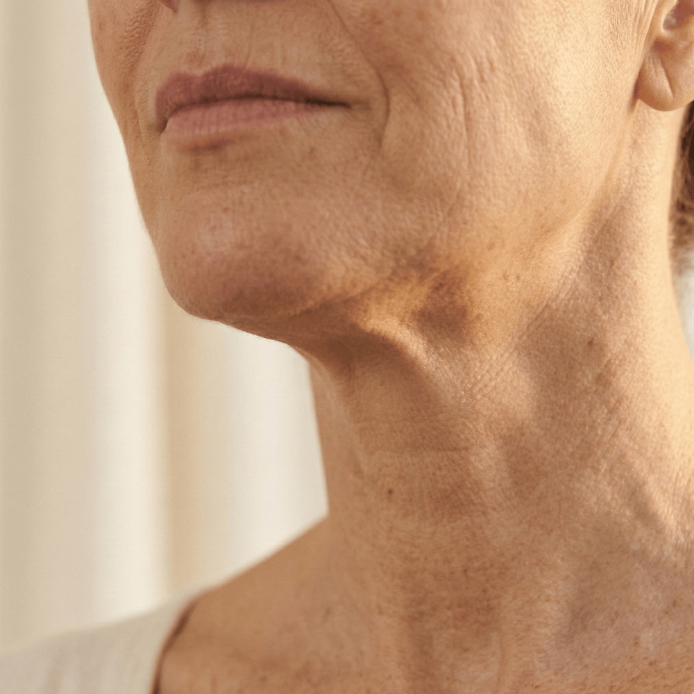 Close-up of mature neck and jawline showing loss of firmness, crepey skin texture and age spots during menopause