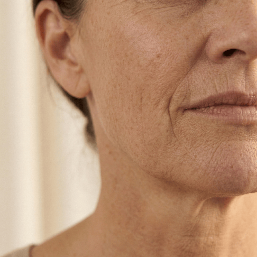Close-up of sagging jawline and nasolabial folds showing loss of facial definition and skin elasticity during menopause