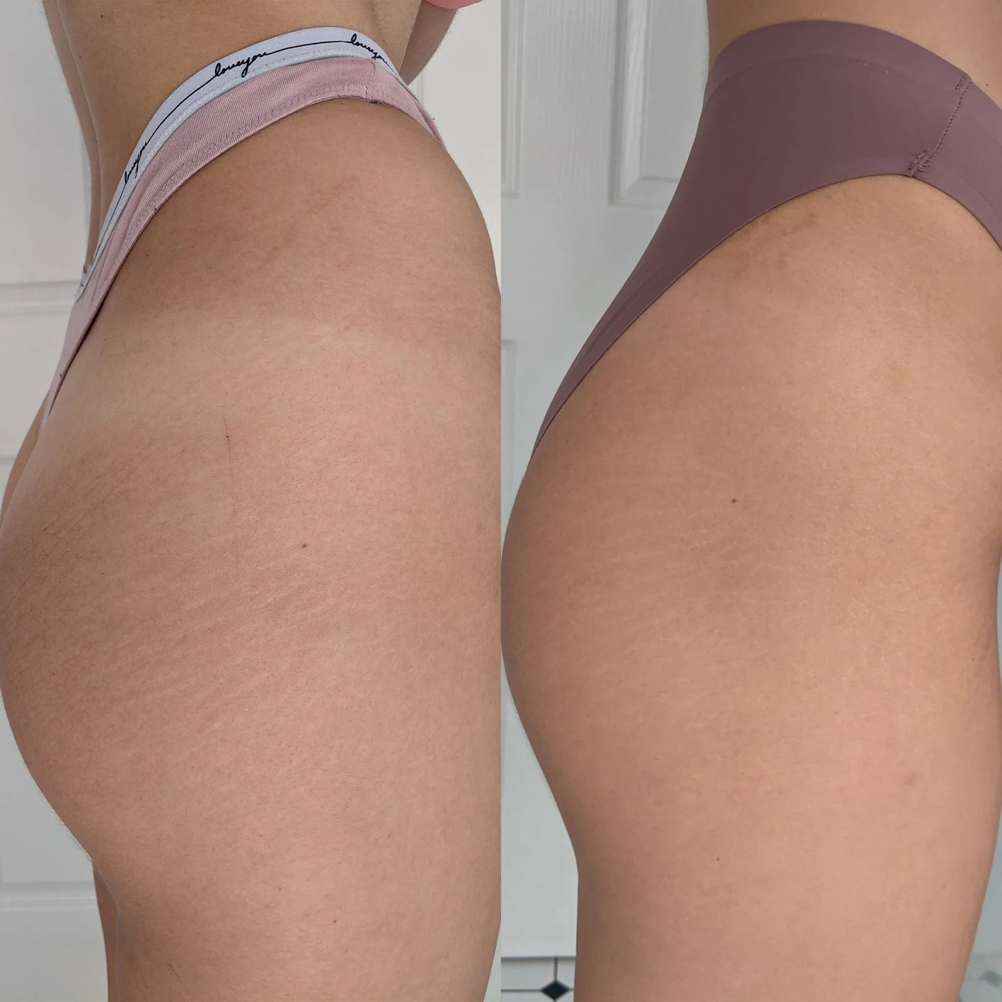 Genova Silicone Scar Gel
