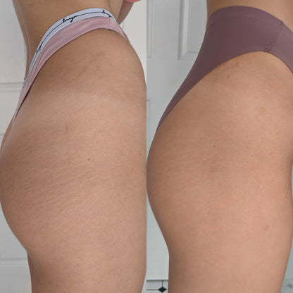 Genova Silicone Scar Gel