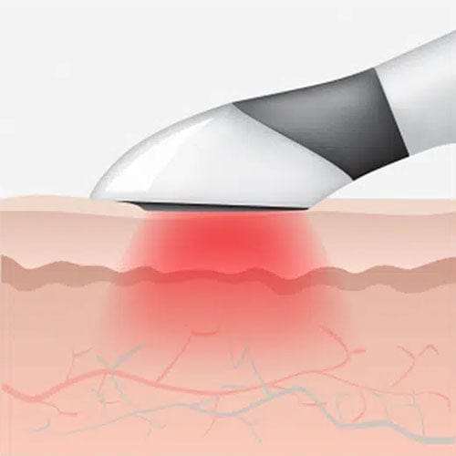 Genova Skincare ION Applicator - Infra Red function