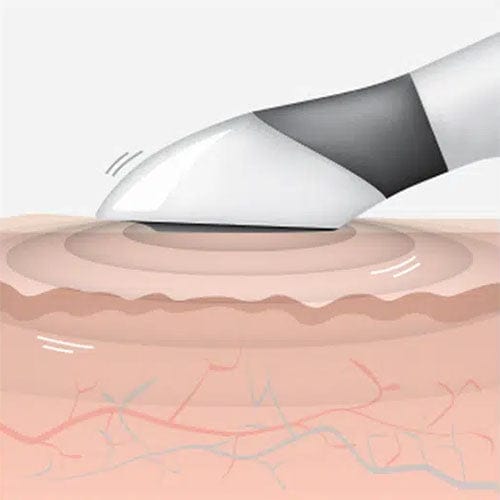 Genova Skincare ION Applicator - Vibration function